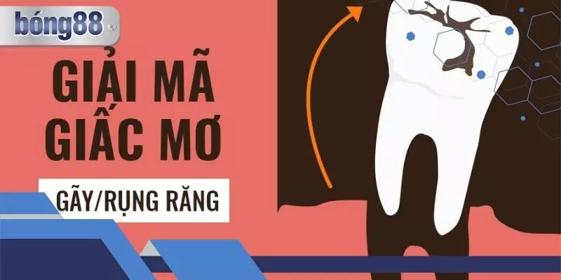 Mơ Thấy Gãy Răng Là Điềm Gì? Luận Giải Ý Nghĩa Và Vận May